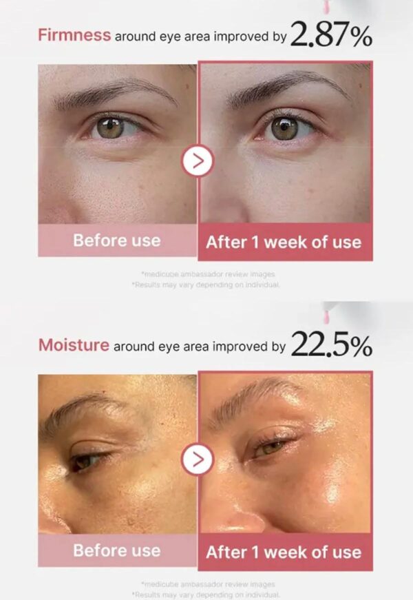 Medicube - PDRN Pink Eye Serum - Imagen 3