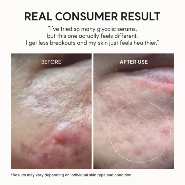Arencia - Eraser Shot Glycolic Acid Booster - Imagen 4